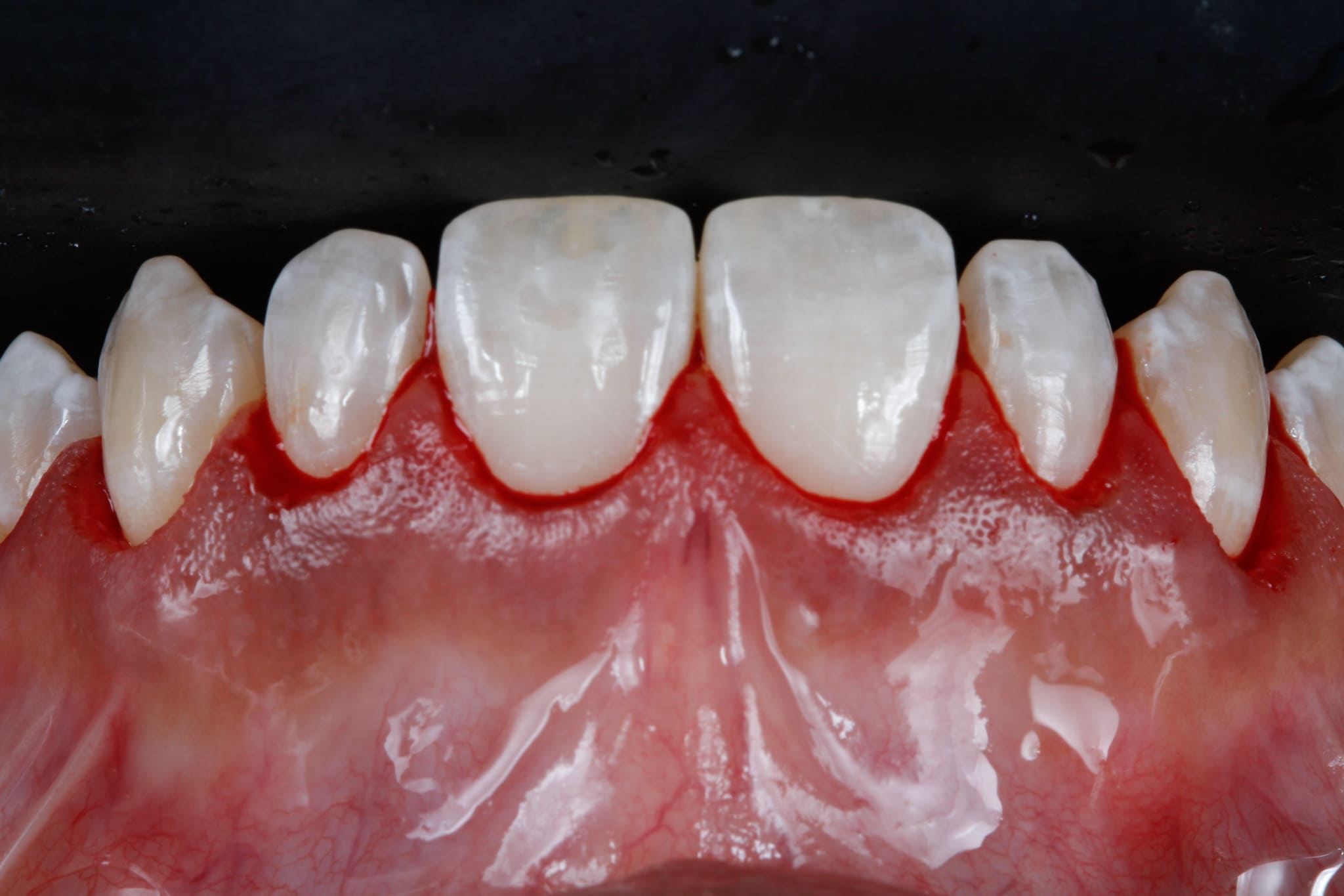 J5184x3456-03369