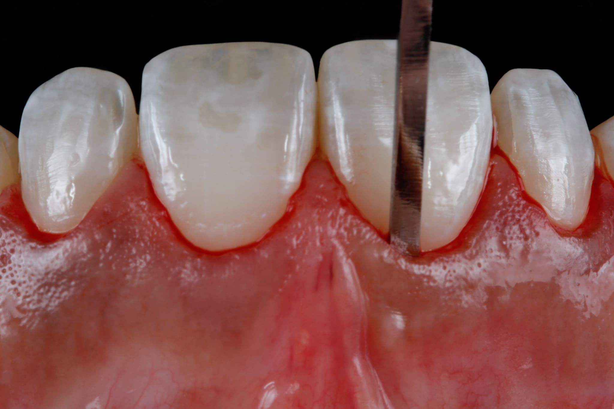 J5184x3456-03861
