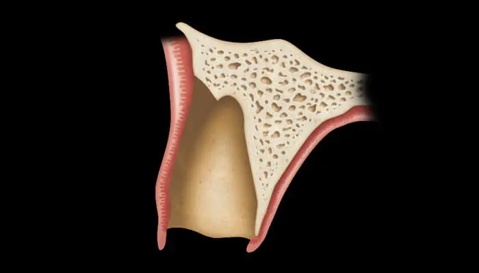 implanteperio_reconstruction-surgery-09